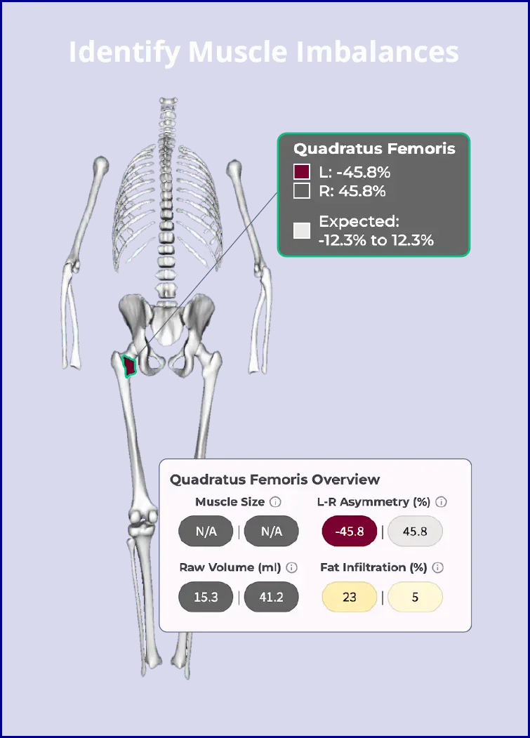 Identify Muscle Imbalances Identify Muscle Imbalances