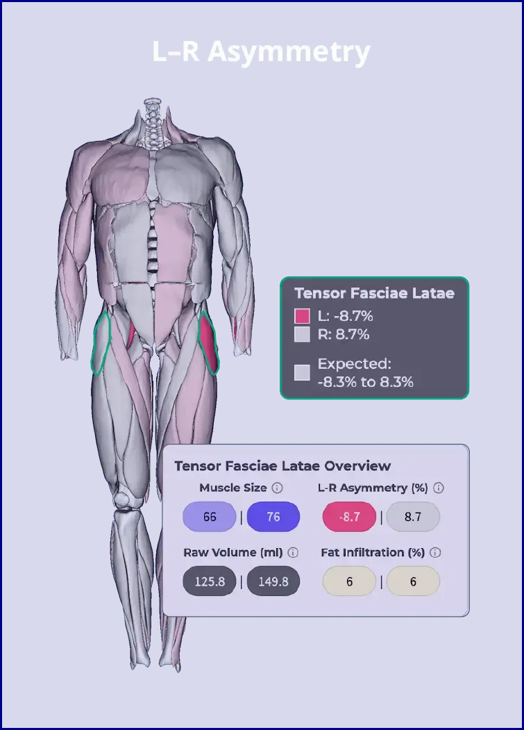 L-R Asymmetry L-R Asymmetry